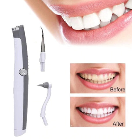 Rechargeable LED Teeth Whitening Kit – Pure Smile White