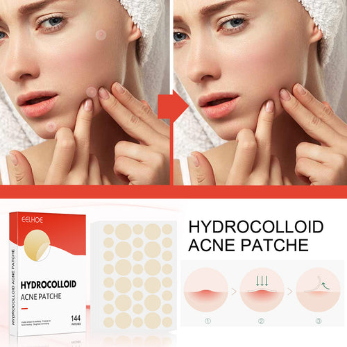 Hydrocolloid Acne Patch Set – 100 PCS | ABA HALL PURE