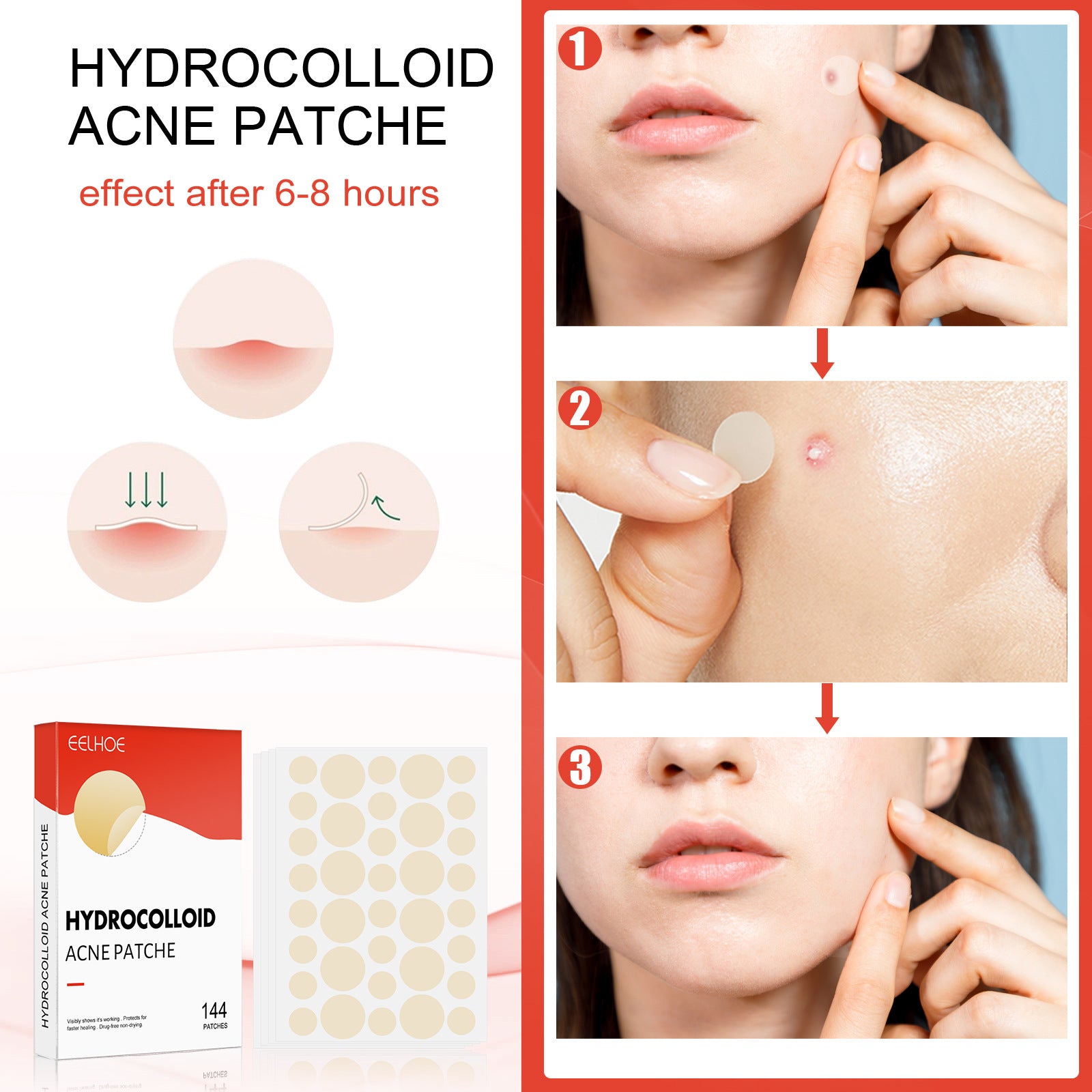 Hydrocolloid Acne Patch Set – 100 PCS | ABA HALL PURE