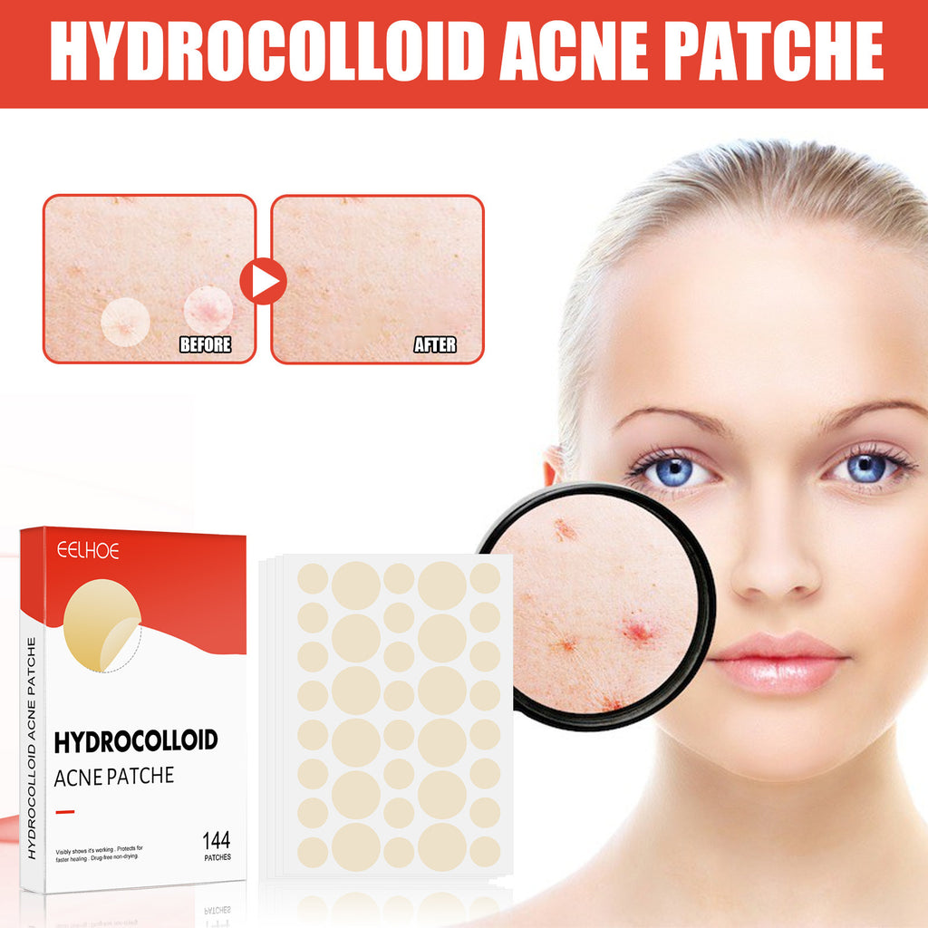 Hydrocolloid Acne Patch Set – 100 PCS | ABA HALL PURE